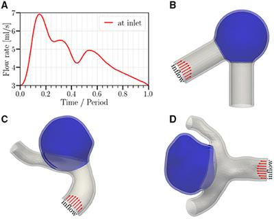 On the Potential Self-Amplification of Aneurysms Due to Tissue Degradation and Blood Flow Revealed From FSI Simulations